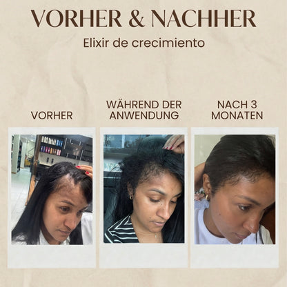 Elixir de Crecimiento